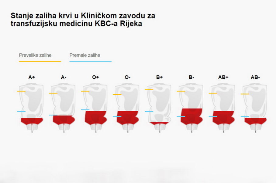 Stanje zaliha krvi u KBC Rijeka 19.1.